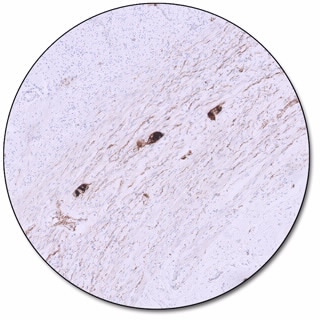 Calretinin (Dako Omnis)