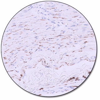 Calretinin (Dako Omnis)