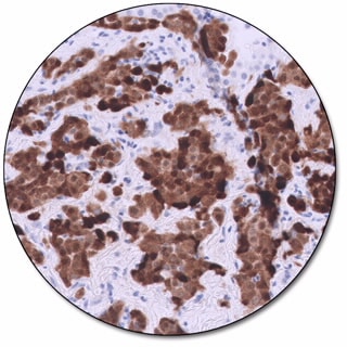 Calretinin (Dako Omnis)