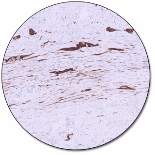 CD56 (Dako Omnis)