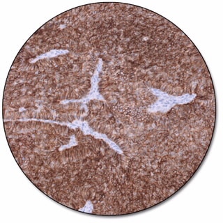 CD56 (Dako Omnis)