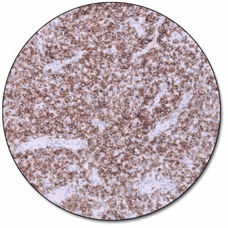 CD56 (Dako Omnis)