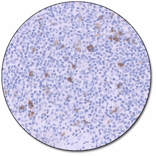 CD56 (Dako Omnis)
