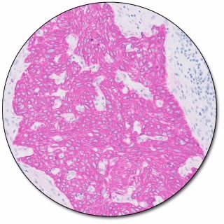 EnVision FLEX HRP Magenta Substrate Chromogen System (Dako Omnis)