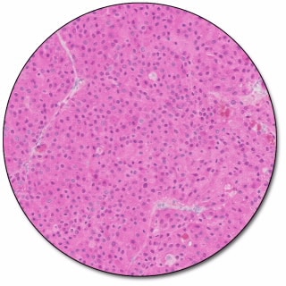 EnVision FLEX HRP Magenta Substrate Chromogen System (Dako Omnis)