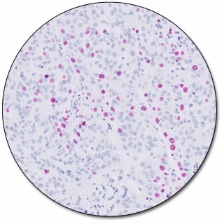 EnVision FLEX HRP Magenta Substrate Chromogen System (Dako Omnis)