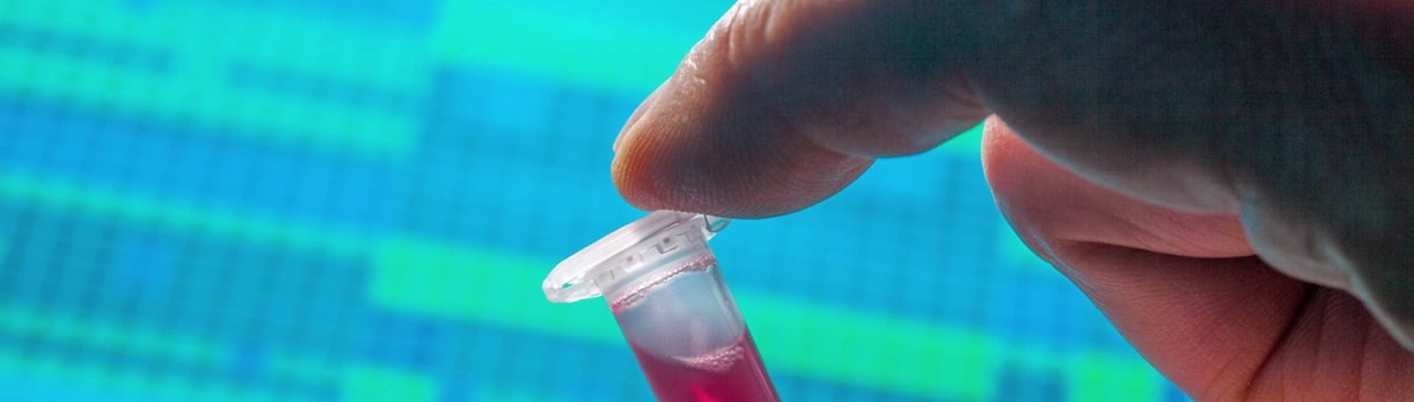 Tandem Affinity Purification Kits | Agilent