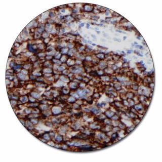 CD30 (Autostainer Link 48)