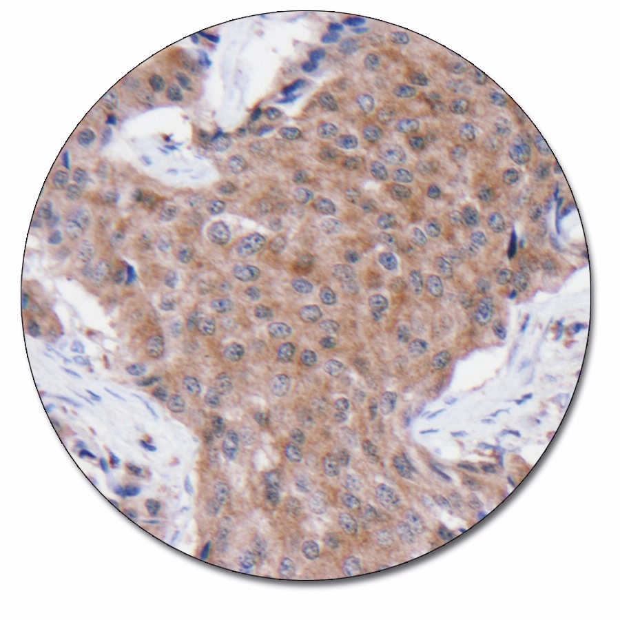Neuron Spec Enolase