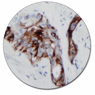 Cytokeratin 17 (Autostainer Link 48)