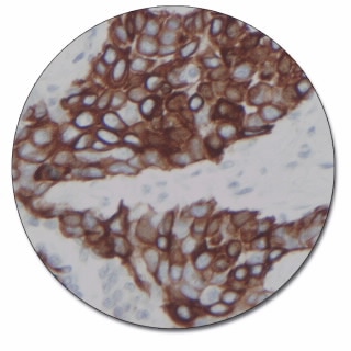 Cytokeratin 17 (Autostainer Link 48)