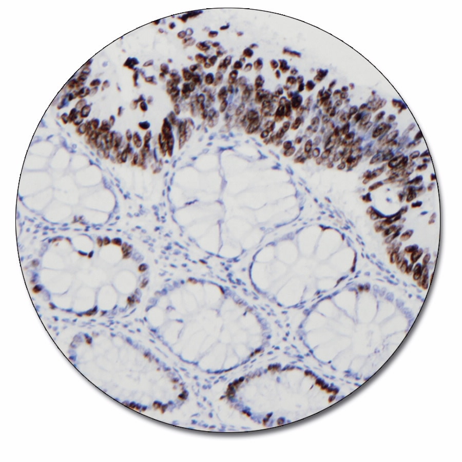 Ki-67 Antigen (Autostainer Link 48)