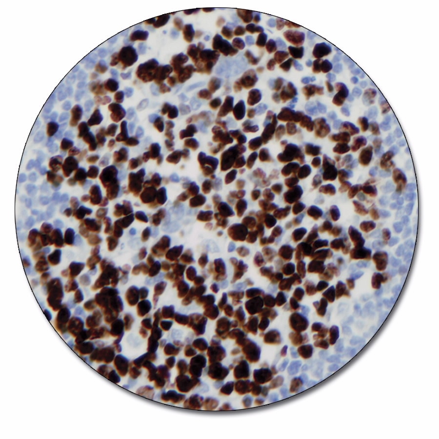 Ki-67 Antigen (Autostainer Link 48)