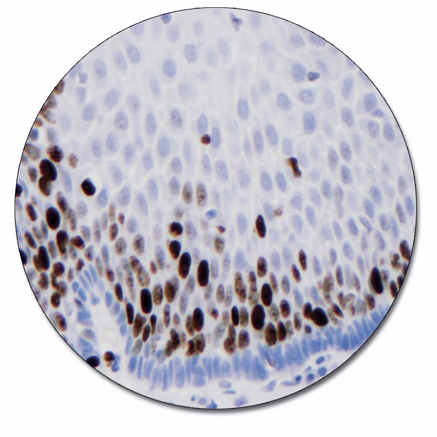 Ki-67 Antigen (Autostainer Link 48)