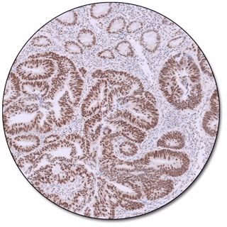 MMR IHC Panel pharmDx (Dako Omnis) 