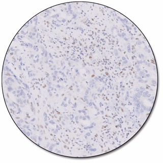 MMR IHC Panel pharmDx (Dako Omnis) 