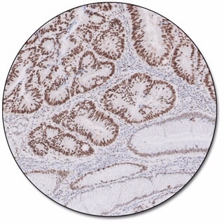 MMR IHC Panel pharmDx (Dako Omnis) 
