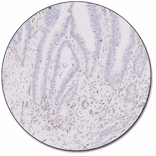 MMR IHC Panel pharmDx (Dako Omnis) 