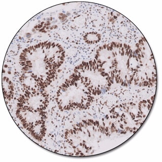 MMR IHC Panel pharmDx (Dako Omnis) 