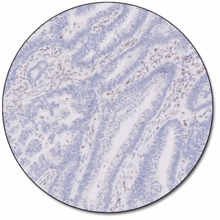 MMR IHC Panel pharmDx (Dako Omnis) 