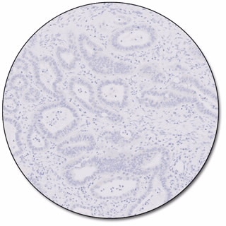 MMR IHC Panel pharmDx (Dako Omnis) 
