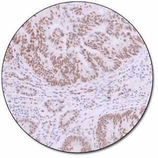 MMR IHC Panel pharmDx (Dako Omnis) 