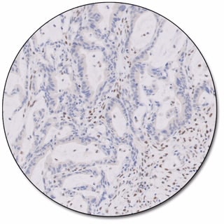 MMR IHC Panel pharmDx (Dako Omnis) 