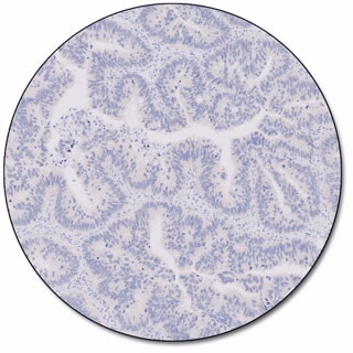 MMR IHC Panel pharmDx (Dako Omnis) 