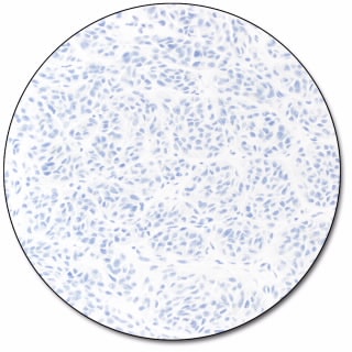 PD-L1 IHC 28-8 pharmDx for Autostainer Link 48