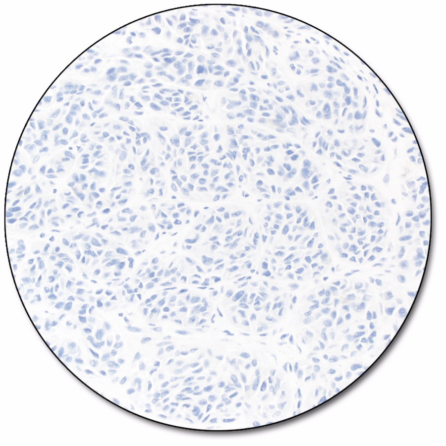 PD-L1 IHC 28-8 pharmDx「ダコ」 (ダコ　Autostainer Link 48 用)