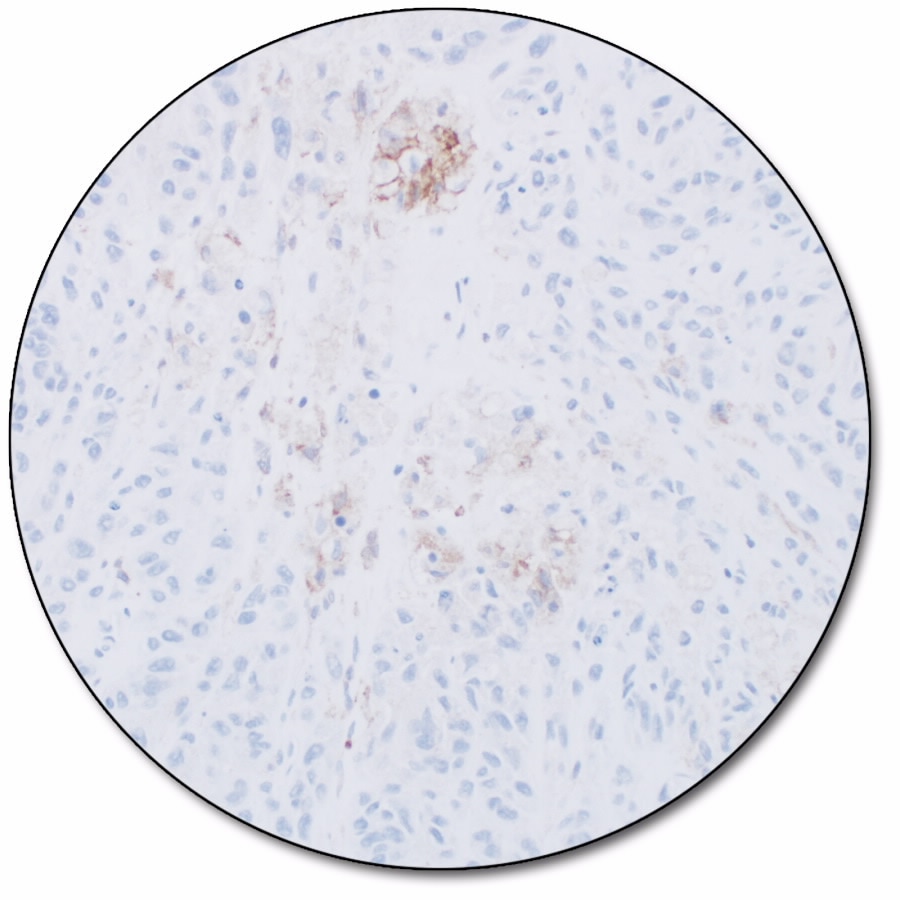 PD-L1 IHC 28-8 pharmDx「ダコ」 (ダコ　Autostainer Link 48 用)