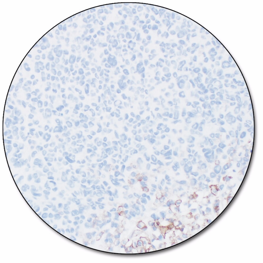 PD-L1 IHC 28-8 pharmDx「ダコ」 (ダコ　Autostainer Link 48 用)
