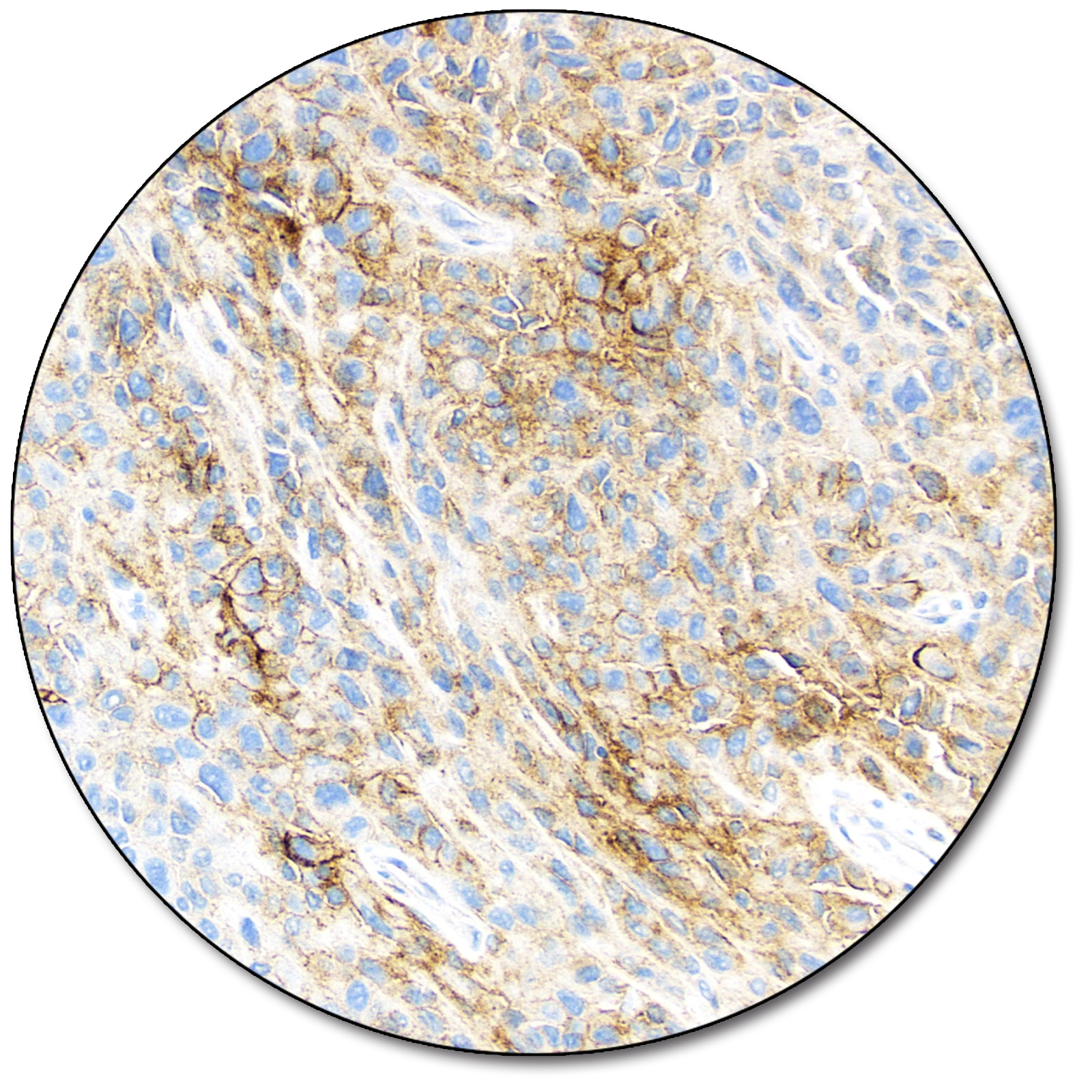 PD-L1 IHC 28-8 pharmDx「ダコ」 (ダコ　Autostainer Link 48 用)