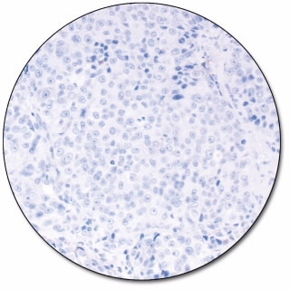 PD-L1 IHC 28-8 pharmDx「ダコ」 (ダコ　Autostainer Link 48 用)