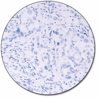 PD-L1 IHC 28-8 pharmDx for Autostainer Link 48