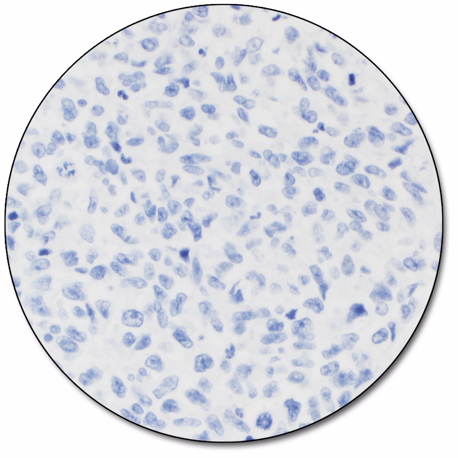 PD-L1 IHC 22C3 pharmDx「ダコ」：ダコ<br><br>Autostainer Link 48 用 PD-L1 検査キット