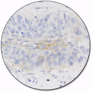 PD-L1 IHC 22C3 pharmDx for Autostainer Link 48