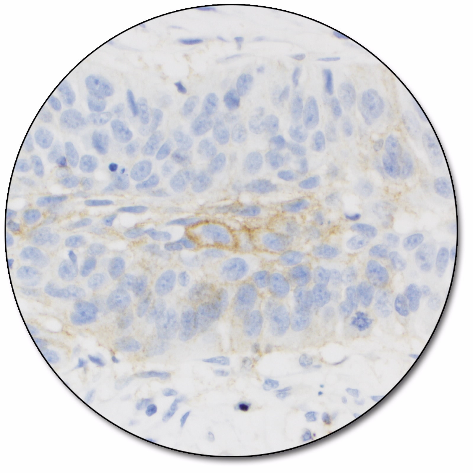 PD-L1 IHC 22C3 pharmDx「ダコ」：ダコ<br><br>Autostainer Link 48 用 PD-L1 検査キット