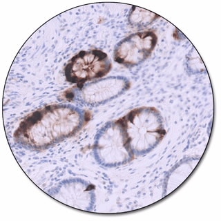 Chromogranin A (Dako Omnis)