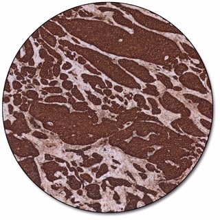 Chromogranin A (Dako Omnis)