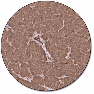 Chromogranin A (Dako Omnis)