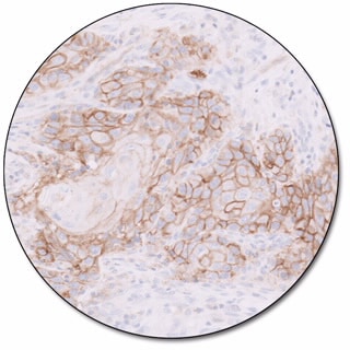 PD-L1 IHC 22C3 pharmDx for Dako Omnis 