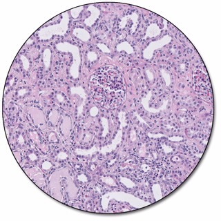 Regressive Staining Package, Large