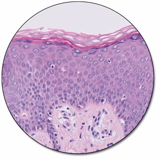 Regressive Staining Package, Large