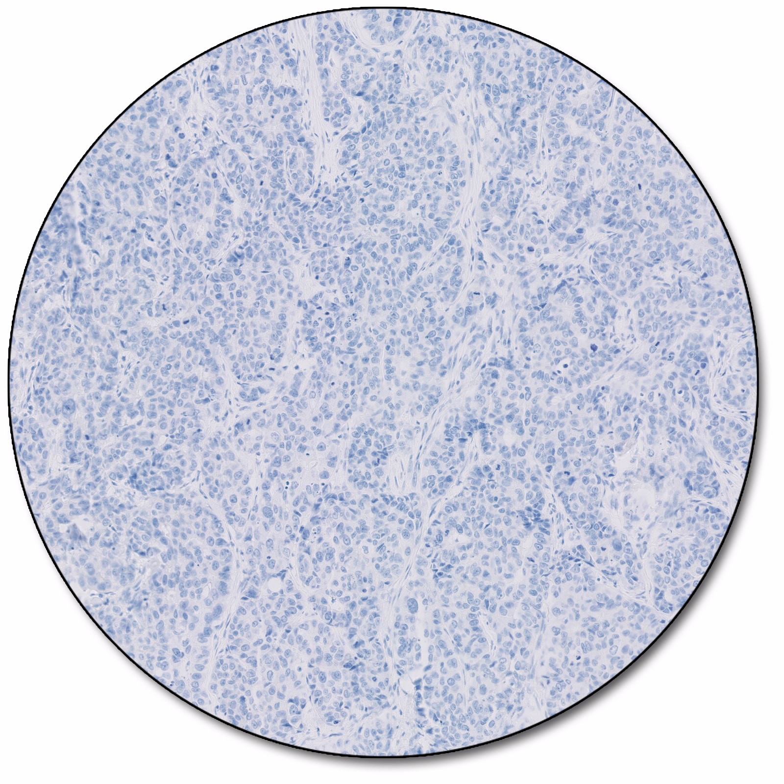 HercepTest™ mAb pharmDx (Dako Omnis)