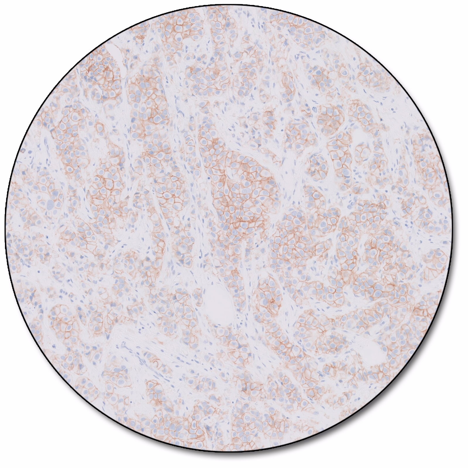 HercepTest™ mAb pharmDx (Dako Omnis)