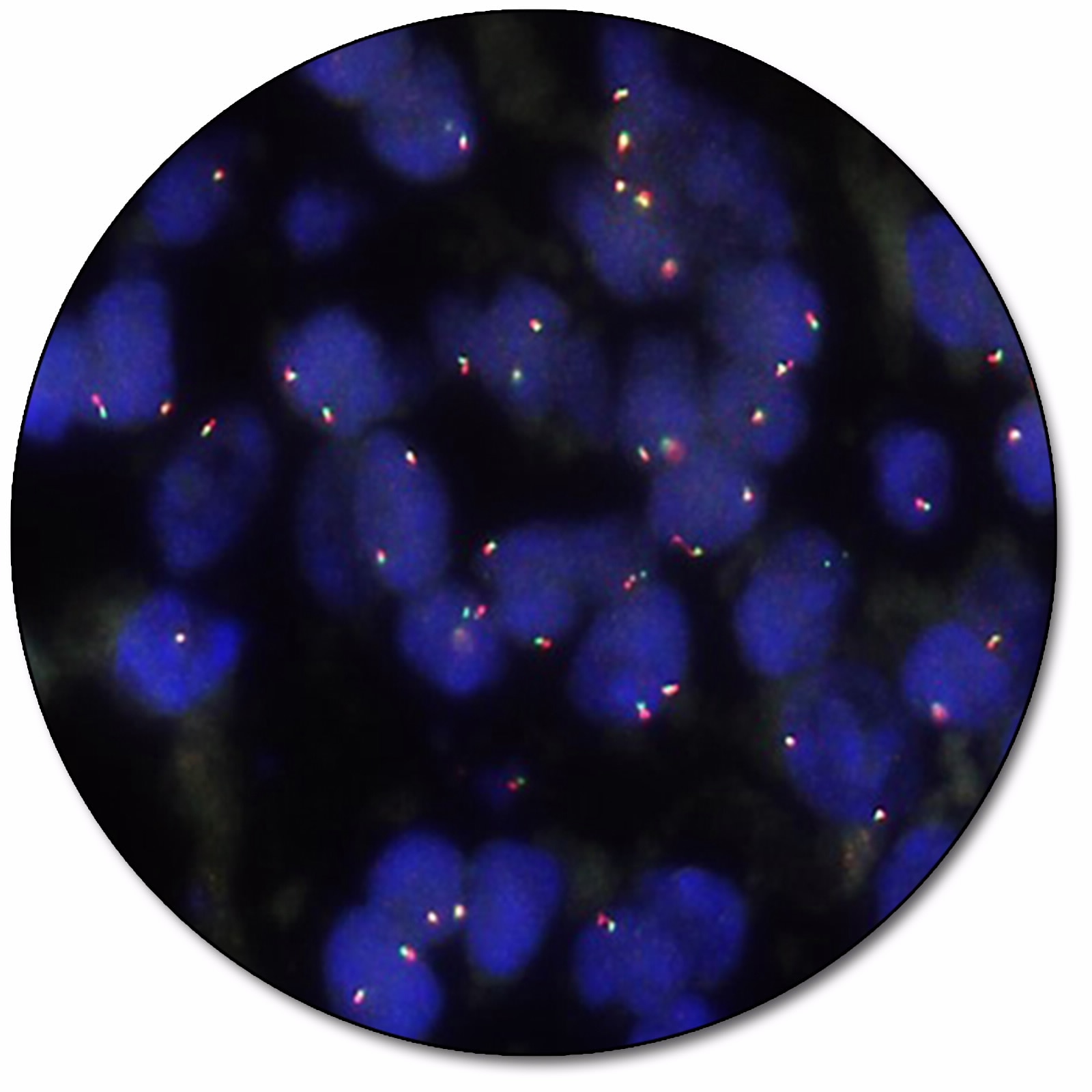 BCL2 IQFISH Break-Apart Probe