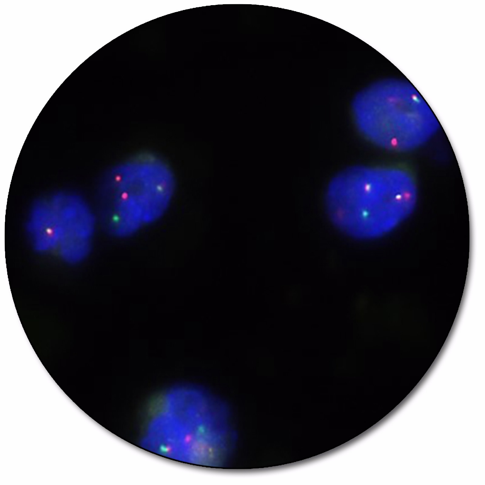 IGH/CCND1 IQFISH Dual Fusion Probe