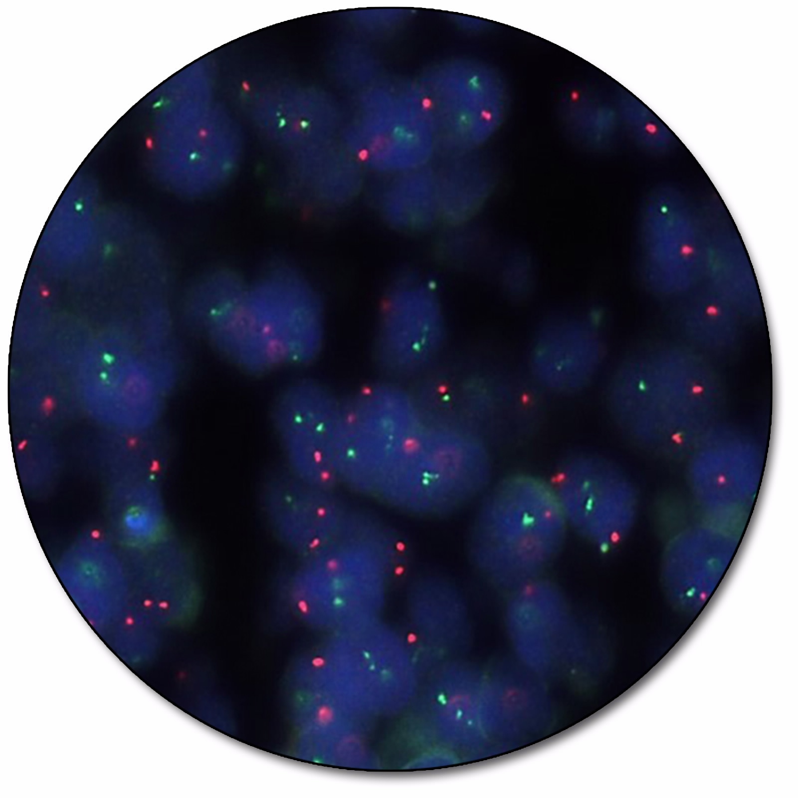 IGH/CCND1 IQFISH Dual Fusion Probe