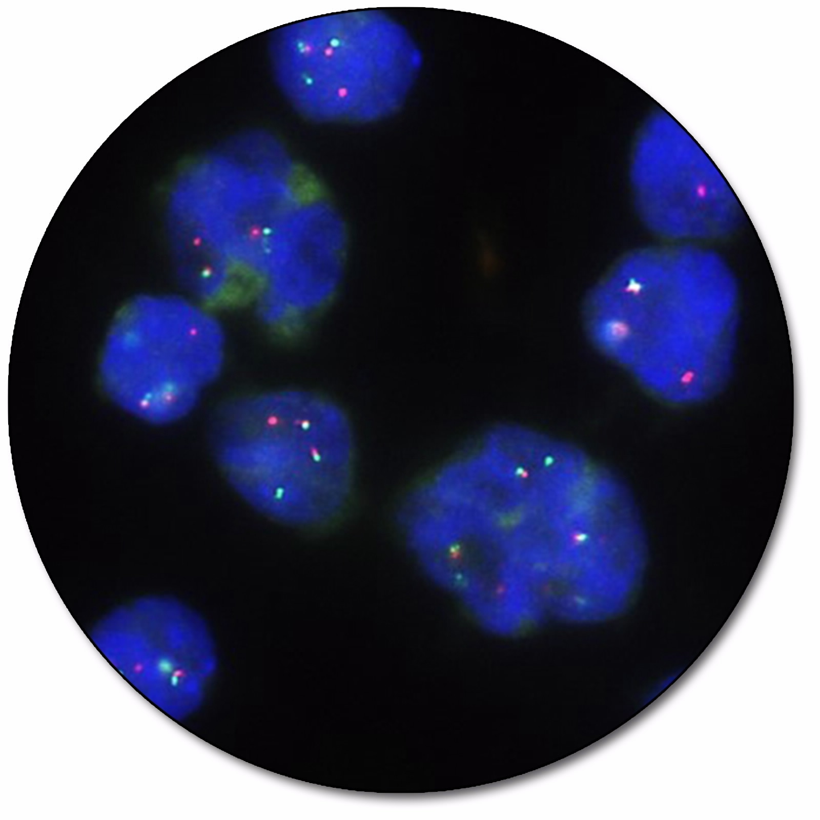 CCND1 IQFISH Break-Apart Probe